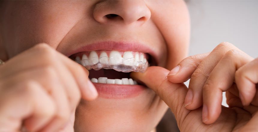 Understanding Teeth Grinding